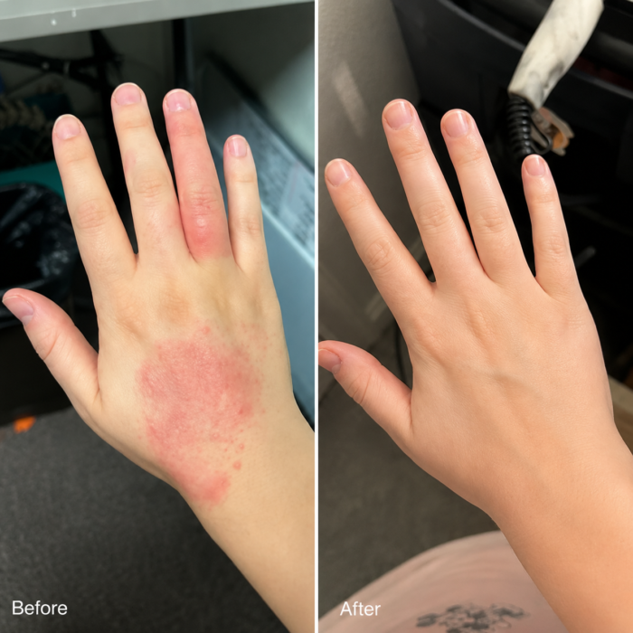 Kremas nuo odos uždegimo & sveika oda – malšina niežėjimą, paraudimą ir pleiskanojimą 50ml - Image 9